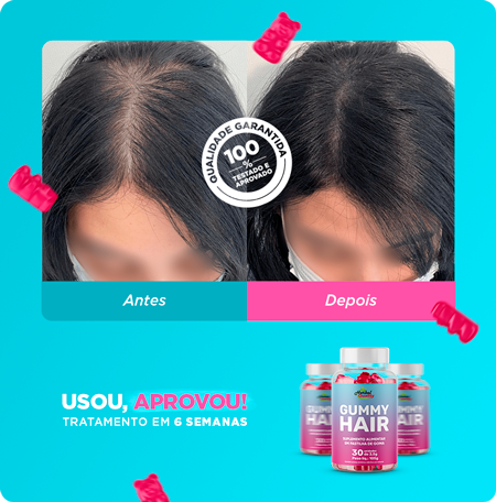 gummyhair-dep-fabiane.png