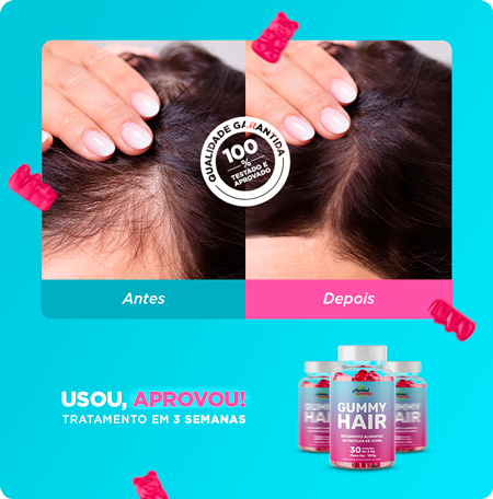 gummyhair-dep-simone.png