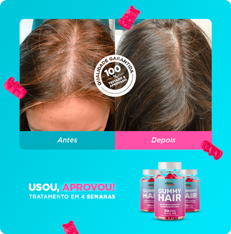 gummyhair-dep-solange.png