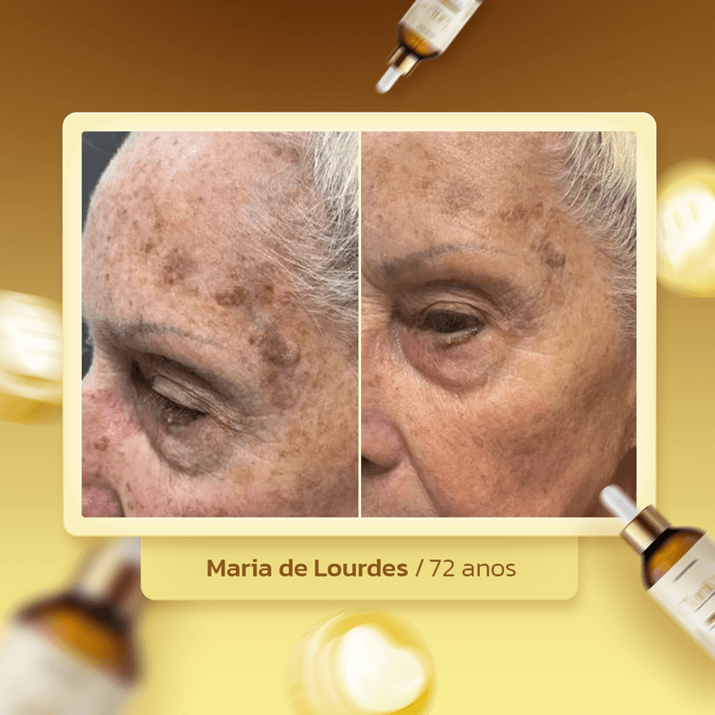 clarityskin-dep-maria
