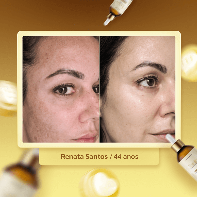 clarityskin-dep-renata