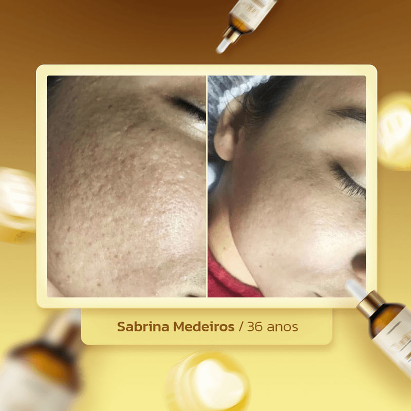clarityskin-dep-sabrina
