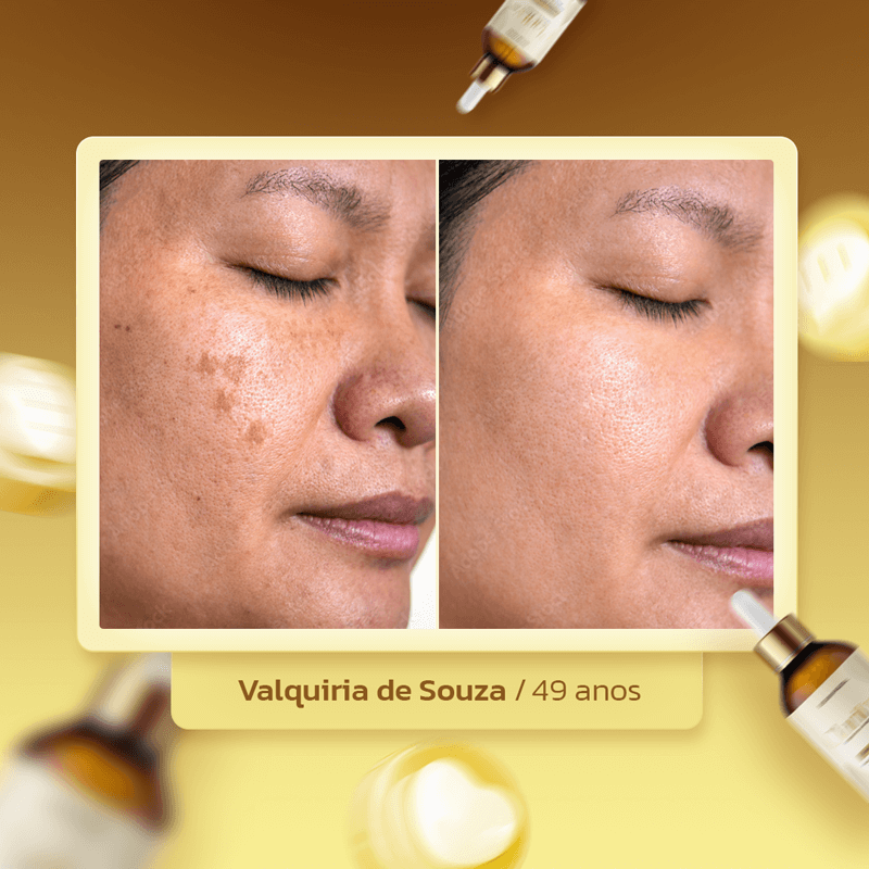 clarityskin-dep-valquiria