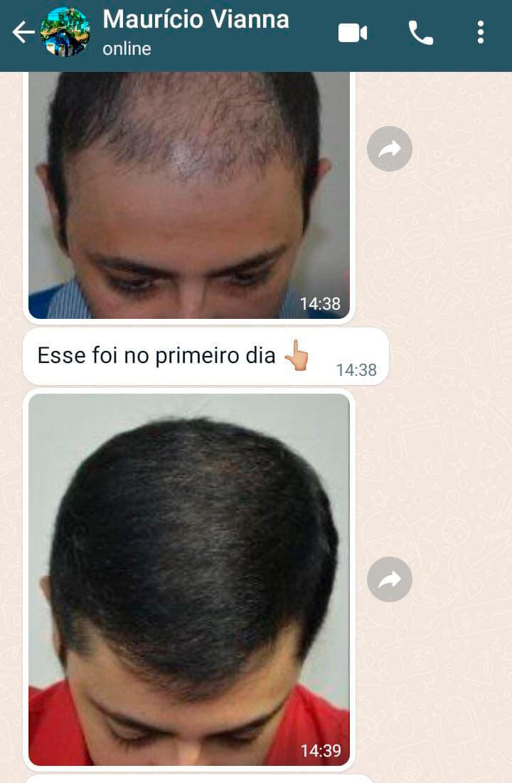 folixil-dep-mauricio